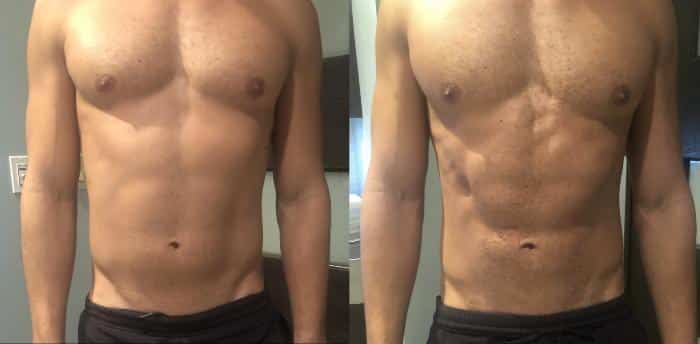 TurboTorp Muscle Stimulator - Before and After Results