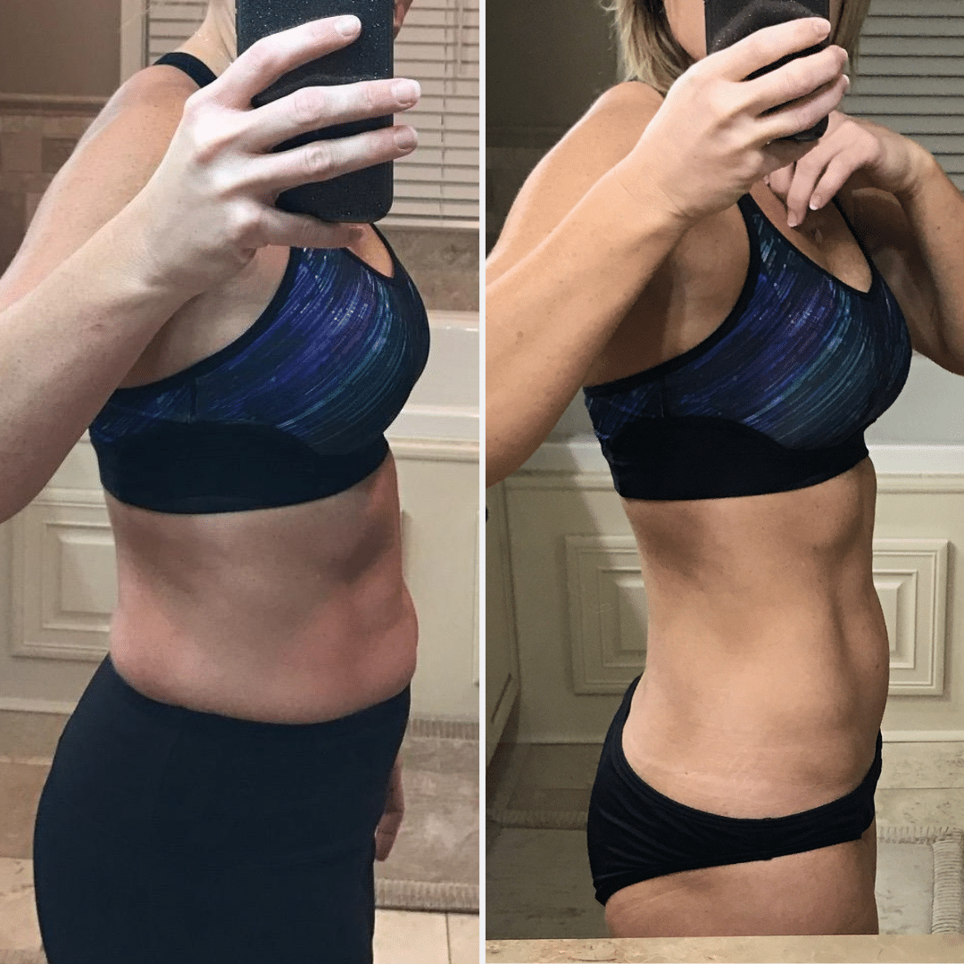 SlimWand - Before and After Results